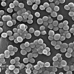 SEM Imaging used for failure analysis 